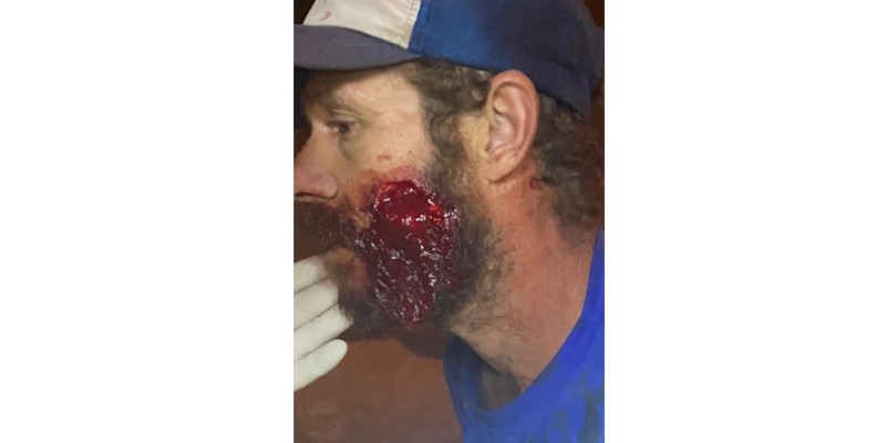 PM cumpre mandado de prisão dentro do Hospital Municipal