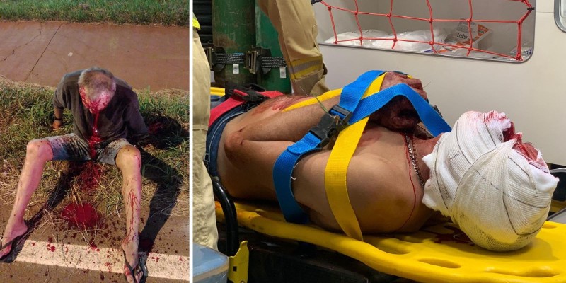 Siate socorre idoso atropelado na paralela da Rodovia BR-277