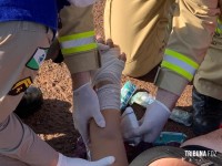 Siate socorre casal vítima de queda de moto no Gleba Guarani