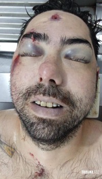 Brasileiro faccionado no PCC morre após confronto com a Policia Nacional em Ciudad Del Este