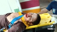 Siate socorre homem alvejado com tiro na face atrás de Furnas