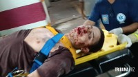 Siate socorre homem alvejado com tiro na face atrás de Furnas