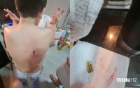 Na noite do Reveillon, bala perdida atinge adolescente dentro de casa em Foz