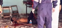 Homem que levou facãozada no Porto Meira nega atendimento do Siate