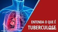 Brasil está na contramão da meta da OMS para extinção da tuberculose