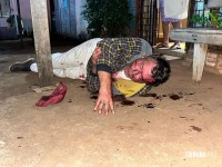 Siate socorre vítima de agressão na marginal da Rodovia BR-277 em Foz do Iguaçu