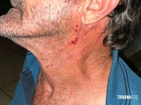 Siate socorre vítima de agressão na marginal da Rodovia BR-277 em Foz do Iguaçu