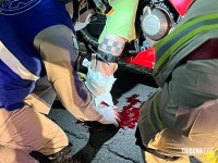 Mulher sofre grave acidente no Bairro Vila A e perde dedos do pé