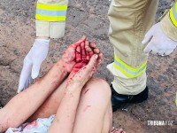 Duas mulheres são feridas a golpes de facão na Favela do Bolo
