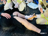 Motociclista fica gravemente ferido após colisão na Av. das Cataratas