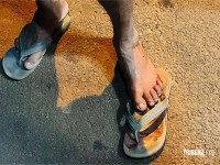 Homem é atacado por cachorro e recusa atendimento médico por estar usando tornozeleira eletrônica