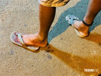 Homem é atacado por cachorro e recusa atendimento médico por estar usando tornozeleira eletrônica