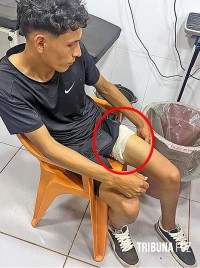 Jovem é alvejado com tiro na perna após disparo acidental em Ytakyry no Paraguai