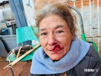 Mulher fica ferida no rosto após ataque com arma branca no Lagoa Dourada