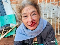 Mulher fica ferida no rosto após ataque com arma branca no Lagoa Dourada