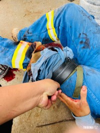 Homem corta a perna com máquina de corte em acidente de trabalho no Jardim das Oliveiras