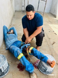 Homem corta a perna com máquina de corte em acidente de trabalho no Jardim das Oliveiras