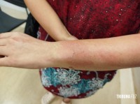 Violência doméstica: Mulher é atacada com água fervente e agressor é preso pela Guarda Municipal