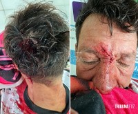 Briga entre vizinhos deixa homem hospitalizado em Ciudad Del Este