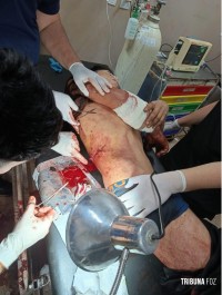 Jovem fica ferido após ser alvejado a tiros em Ciudad Del Este Jovem fica ferido após ser alvejado a tiros em Ciudad Del Este