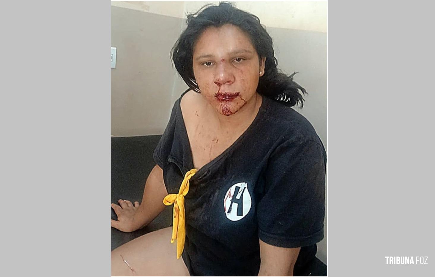 Derrubou a ex-esposa da moto, a espancou e ainda ameaçou de morte em Minga Guazu