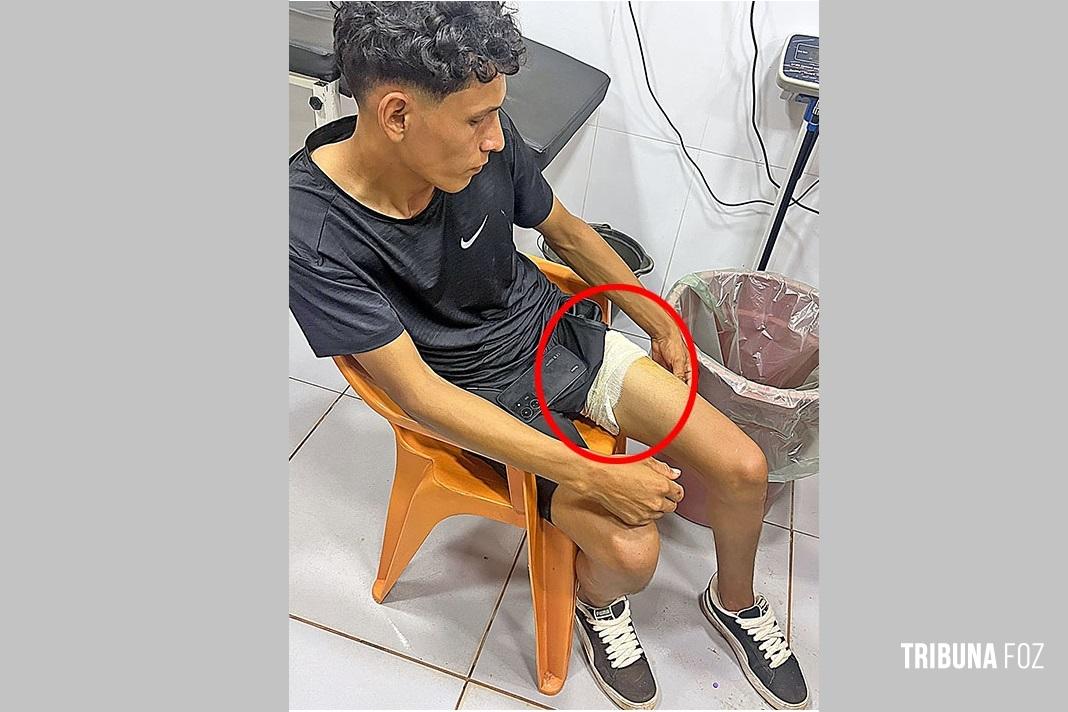 Jovem é alvejado com tiro na perna após disparo acidental em Ytakyry no Paraguai