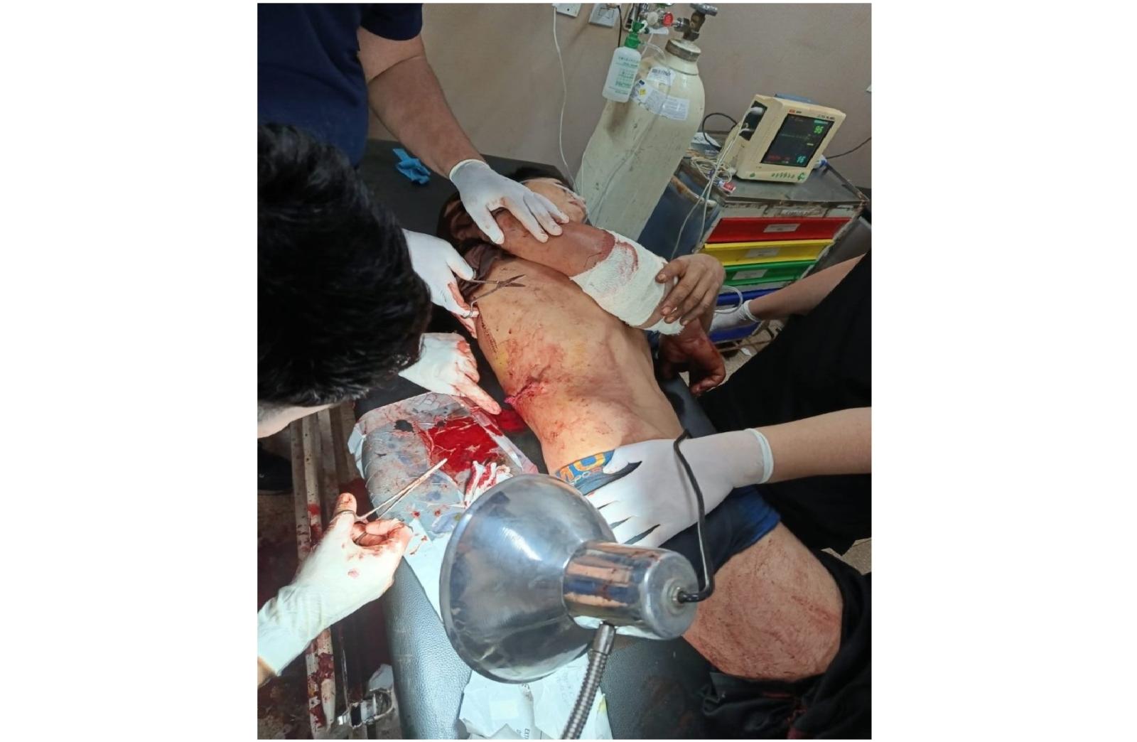 Jovem fica ferido após ser alvejado a tiros em Ciudad Del Este