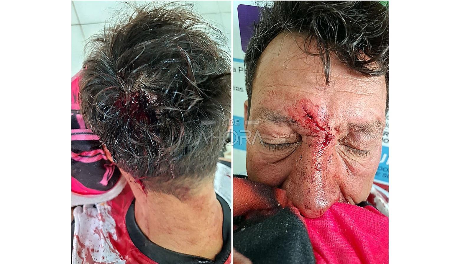 Briga entre vizinhos deixa homem hospitalizado em Ciudad Del Este