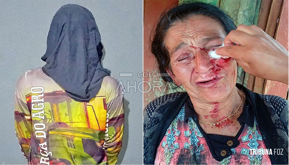 Comunidade indígena e Policia Nacional prendem jovem que desfigurou a mãe em Itakyry, no Paraguai